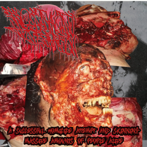 A Succesful Homicide Attempt and skinning Massive Amounts of People Alive